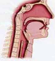 False croup